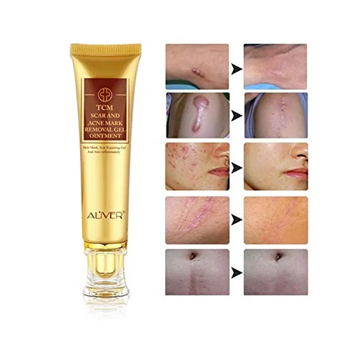 Lanbena TCM Scar And Acne Mark Removal Cream